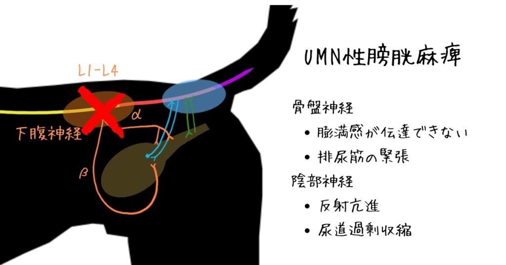 UMN性膀胱麻痺の各神経異常