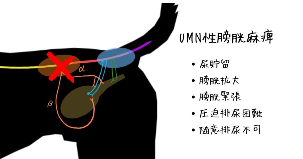 UMN性膀胱麻痺の臨床症状