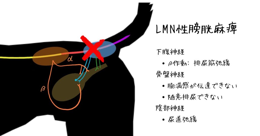 LMN性膀胱麻痺の各神経異常
