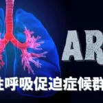 急性呼吸促迫症候群（ARDS: Acute Respiratory Distress Syndrome）とは/アメリカ獣医レジデント備忘録